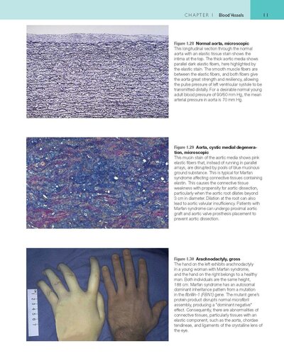 Robbins and Cotran Atlas of Pathology (Robbins Pathology) 4th Edition