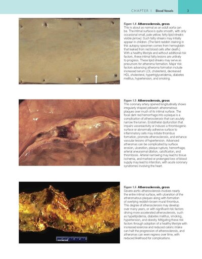 Robbins and Cotran Atlas of Pathology (Robbins Pathology) 4th Edition
