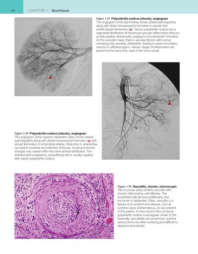 Robbins and Cotran Atlas of Pathology (Robbins Pathology) 4th Edition