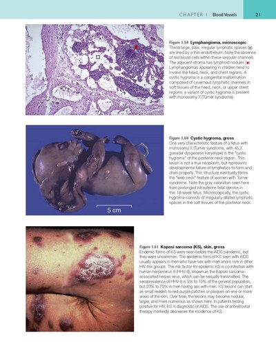 Robbins and Cotran Atlas of Pathology (Robbins Pathology) 4th Edition