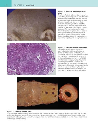 Robbins and Cotran Atlas of Pathology (Robbins Pathology) 4th Edition