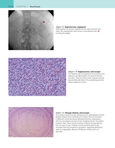 Robbins and Cotran Atlas of Pathology (Robbins Pathology) 4th Edition