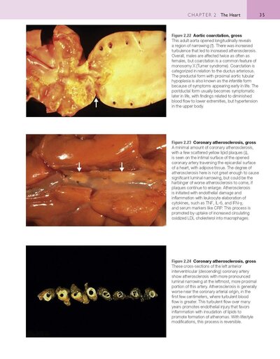 Robbins and Cotran Atlas of Pathology (Robbins Pathology) 4th Edition