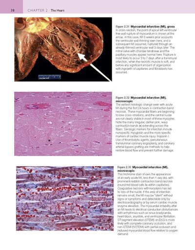 Robbins and Cotran Atlas of Pathology (Robbins Pathology) 4th Edition
