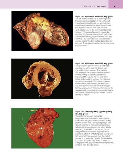 Robbins and Cotran Atlas of Pathology (Robbins Pathology) 4th Edition