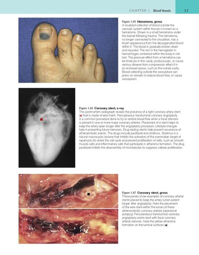 Robbins and Cotran Atlas of Pathology (Robbins Pathology) 4th Edition