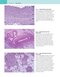 Robbins and Cotran Atlas of Pathology (Robbins Pathology) 4th Edition