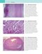 Robbins and Cotran Atlas of Pathology (Robbins Pathology) 4th Edition