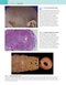 Robbins and Cotran Atlas of Pathology (Robbins Pathology) 4th Edition