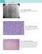 Robbins and Cotran Atlas of Pathology (Robbins Pathology) 4th Edition