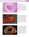 Robbins and Cotran Atlas of Pathology (Robbins Pathology) 4th Edition