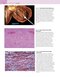 Robbins and Cotran Atlas of Pathology (Robbins Pathology) 4th Edition