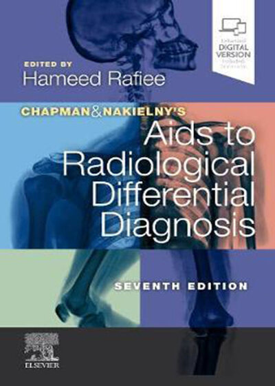 Chapman & Nakielny's Aids to Radiological Differential Diagnosis: 7th Edition