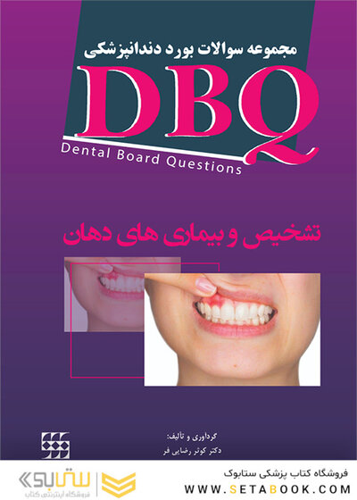 DBQ تشخیص و بیماری های دهان مجموعه سوالات بورد دندانپزشکی