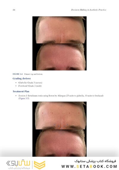 Decision Making in Aesthetic Practice: The Right Procedures for the Right Patients