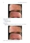 Decision Making in Aesthetic Practice: The Right Procedures for the Right Patients