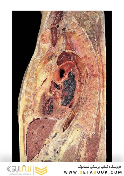 Photographic Atlas of Anatomy2021