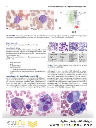 Atlas of Differential Diagnosis in Neoplastic Hematopathology2021