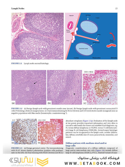 Atlas of Differential Diagnosis in Neoplastic Hematopathology2021