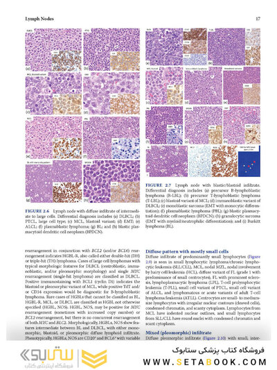 Atlas of Differential Diagnosis in Neoplastic Hematopathology2021