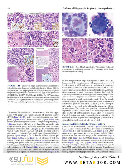 Atlas of Differential Diagnosis in Neoplastic Hematopathology2021