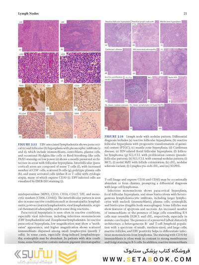 Atlas of Differential Diagnosis in Neoplastic Hematopathology2021
