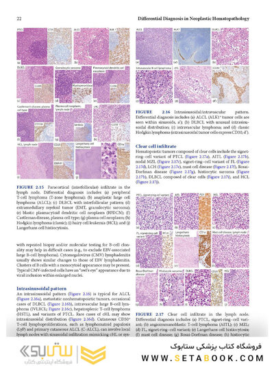 Atlas of Differential Diagnosis in Neoplastic Hematopathology2021