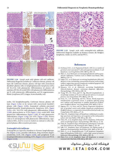 Atlas of Differential Diagnosis in Neoplastic Hematopathology2021