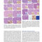 Atlas of Differential Diagnosis in Neoplastic Hematopathology2021