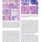 Atlas of Differential Diagnosis in Neoplastic Hematopathology2021