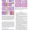 Atlas of Differential Diagnosis in Neoplastic Hematopathology2021