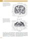 Principles and Practice of Movement Disorders