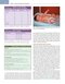 Smith's Anesthesia for Infants and Children 10th Edicion
