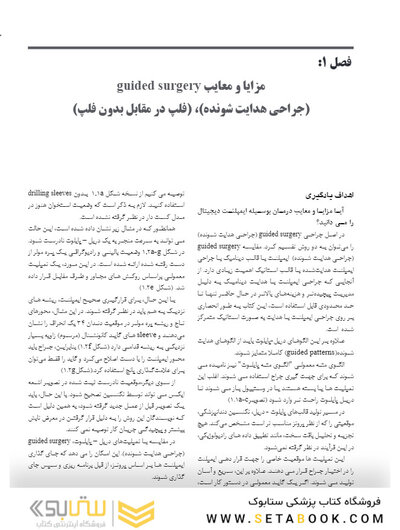 جراحی هدایت شونده در ایمپلنتولوژی