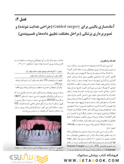 جراحی هدایت شونده در ایمپلنتولوژی