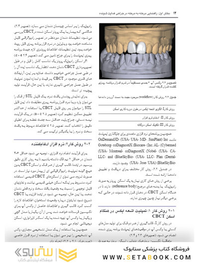 جراحی هدایت شونده در ایمپلنتولوژی
