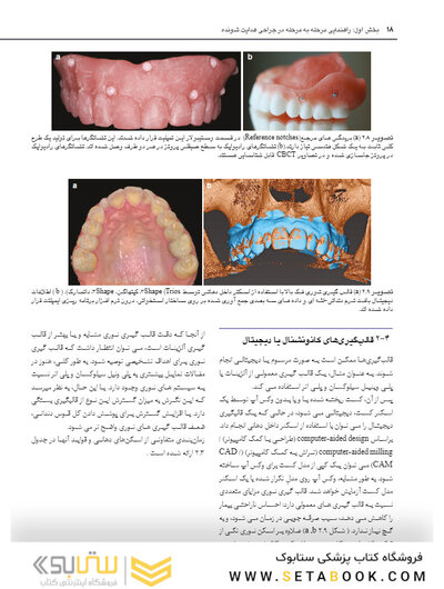 جراحی هدایت شونده در ایمپلنتولوژی