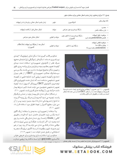جراحی هدایت شونده در ایمپلنتولوژی