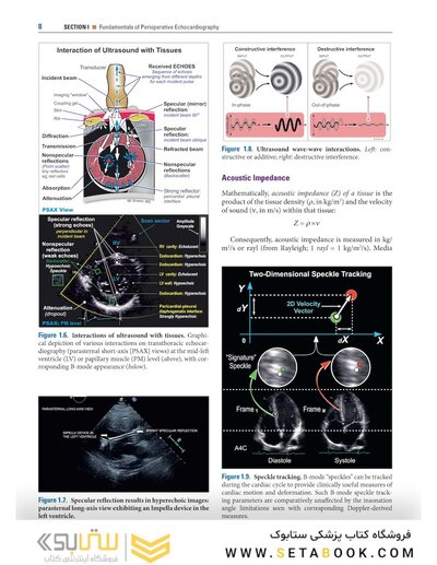 Savage & Aronson's Comprehensive Textbook of Perioperative and Critical Care Echocardiography