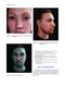 Non-Surgical Rhinoplasty (The PRIME Series) Kindle Edition