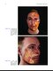 Non-Surgical Rhinoplasty (The PRIME Series) Kindle Edition