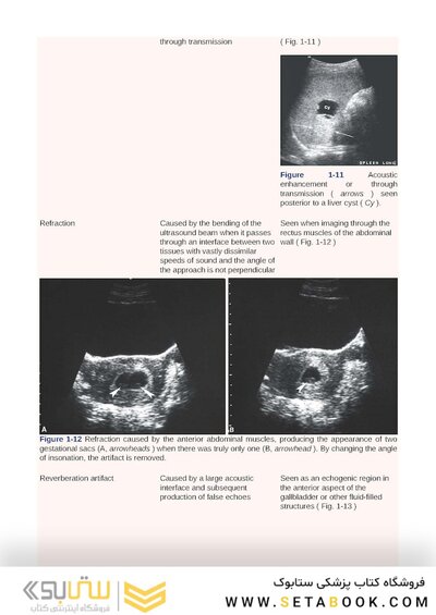 Examination Review for Ultrasound: Abdomen and Obstetrics & Gynecology Third Edition