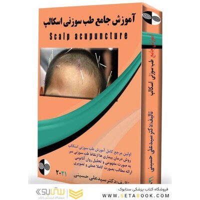 آموزش طب سوزنی اسکالپ سر