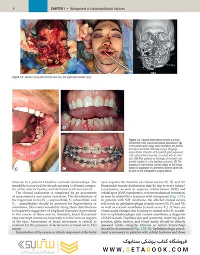 Plastic Surgery Neligan Volume 3: Craniofacial, Head and Neck Surgery and Pediatric Plastic Surgery 5th Edition 2023