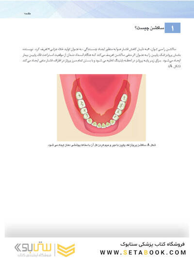 همه می توانند به پروتز کامل فک پایین با ساکشن دست یابند SEMCD