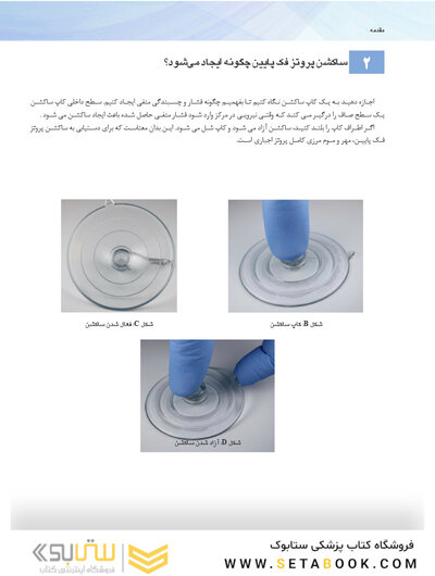 همه می توانند به پروتز کامل فک پایین با ساکشن دست یابند SEMCD