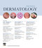 Dermatology, 5th Edition 2025
