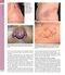 Dermatology, 5th Edition 2025