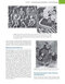 Fanaroff and Martin's Neonatal-Perinatal Medicine, 2-Volume Set: Diseases of the Fetus and Infant 12th Edition 2025