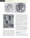 Fanaroff and Martin's Neonatal-Perinatal Medicine, 2-Volume Set: Diseases of the Fetus and Infant 12th Edition 2025